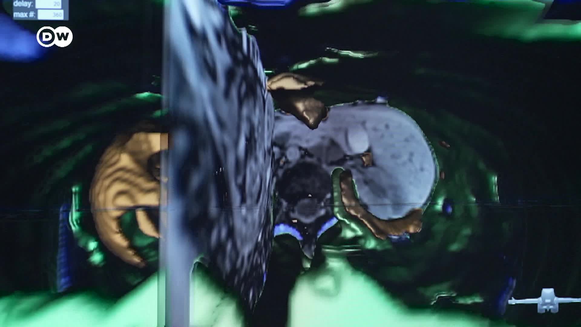 DW Tomorrow Today - 2/20/26